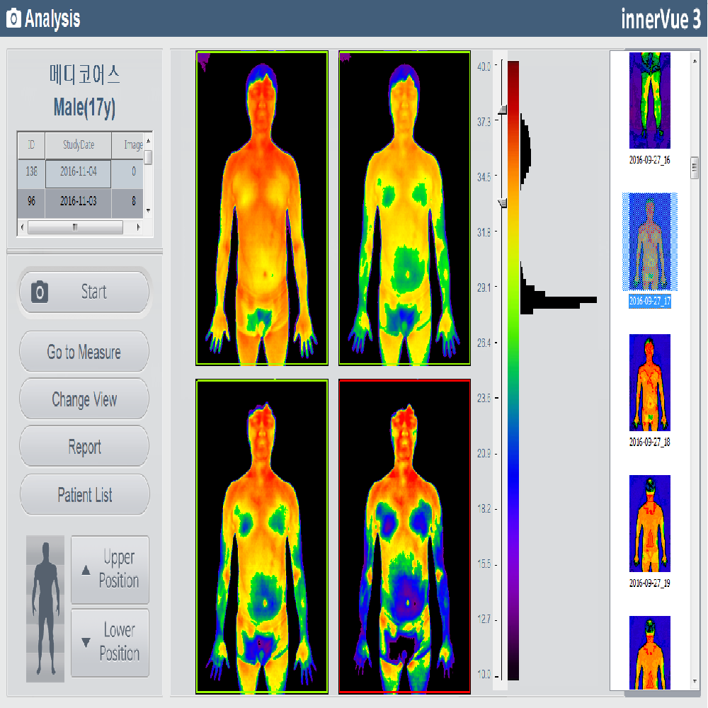 Digital Infrared Thermal Imaging System