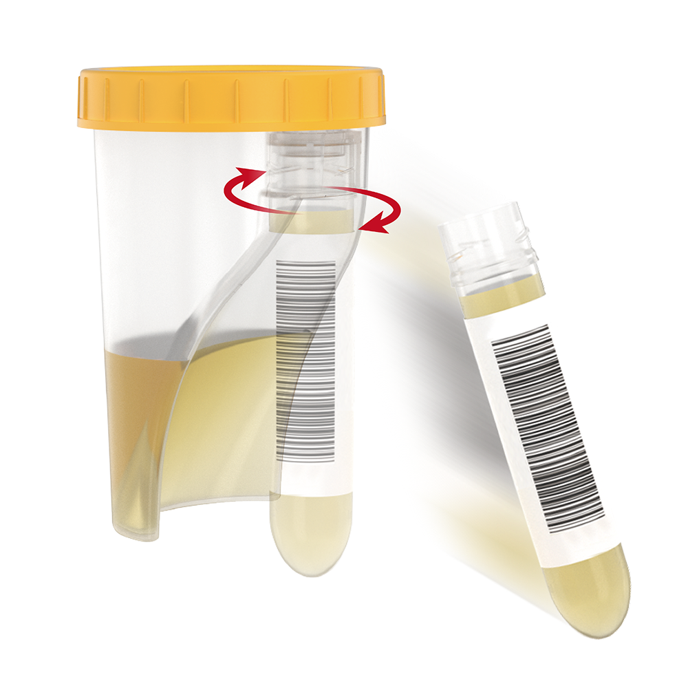 TUBYCON Single Tube Urine Test Cup Kit